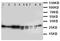 Peroxiredoxin 3 antibody, LS-C312980, Lifespan Biosciences, Western Blot image 