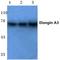 Elongin A3 antibody, GTX66855, GeneTex, Western Blot image 