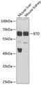 Biotinidase antibody, GTX33046, GeneTex, Western Blot image 