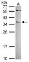 Retinoic Acid Receptor Responder 1 antibody, NBP2-20079, Novus Biologicals, Western Blot image 