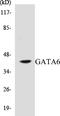 GATA Binding Protein 6 antibody, EKC1238, Boster Biological Technology, Western Blot image 