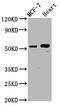 NOP53 Ribosome Biogenesis Factor antibody, LS-C680960, Lifespan Biosciences, Western Blot image 