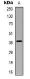 Carbohydrate Sulfotransferase 13 antibody, LS-C368886, Lifespan Biosciences, Western Blot image 