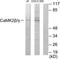 Calcium/Calmodulin Dependent Protein Kinase II Gamma antibody, TA313553, Origene, Western Blot image 