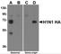 Seasonal H1N1 Hemagglutinin antibody, 5235, ProSci, Western Blot image 