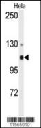 Actinin Alpha 4 antibody, 63-206, ProSci, Western Blot image 