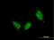 Titin antibody, H00007273-M06, Novus Biologicals, Immunofluorescence image 