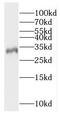 RAD1 Checkpoint DNA Exonuclease antibody, FNab07073, FineTest, Western Blot image 
