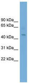 Eukaryotic Translation Initiation Factor 4A1 antibody, TA346512, Origene, Western Blot image 