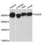 Protein CASC5 antibody, A13108, ABclonal Technology, Western Blot image 