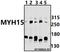 Myosin Heavy Chain 15 antibody, A11836, Boster Biological Technology, Western Blot image 