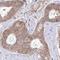 Ribosomal Protein S15 antibody, HPA054510, Atlas Antibodies, Immunohistochemistry paraffin image 