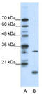 Protein max antibody, TA335837, Origene, Western Blot image 