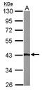ARSA antibody, LS-C186356, Lifespan Biosciences, Western Blot image 