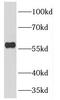 L-dopachrome tautomerase antibody, FNab02272, FineTest, Western Blot image 