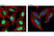 TIA1 Cytotoxic Granule Associated RNA Binding Protein Like 1 antibody, 8611S, Cell Signaling Technology, Immunofluorescence image 