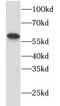 HLA class II histocompatibility antigen, DM alpha chain antibody, FNab03900, FineTest, Western Blot image 