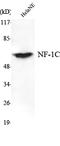 Nuclear Factor I C antibody, A04154, Boster Biological Technology, Western Blot image 