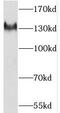 Plakophilin 4 antibody, FNab06501, FineTest, Western Blot image 