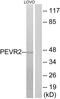 Riboflavin transporter 1 antibody, PA5-39703, Invitrogen Antibodies, Western Blot image 