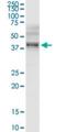 UDP-GlcNAc:betaGal beta-1,3-N-acetylglucosaminyltransferase 3 antibody, H00010331-D01P, Novus Biologicals, Western Blot image 