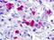 Gonadotropin Releasing Hormone Receptor antibody, NLS209, Novus Biologicals, Immunohistochemistry frozen image 