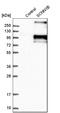 Sodium Channel Epithelial 1 Beta Subunit antibody, HPA015612, Atlas Antibodies, Western Blot image 