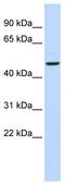 ADP Dependent Glucokinase antibody, TA337262, Origene, Western Blot image 