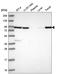 Neuregulin 2 antibody, HPA047973, Atlas Antibodies, Western Blot image 