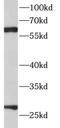 TIMP Metallopeptidase Inhibitor 4 antibody, FNab08709, FineTest, Western Blot image 