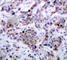 p65 antibody, AP0447, ABclonal Technology, Immunohistochemistry paraffin image 