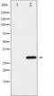 Cyclin D3 antibody, TA325314, Origene, Western Blot image 