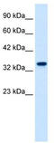 Zinc Finger Protein 2 antibody, TA339527, Origene, Western Blot image 