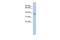 Kelch Domain Containing 8B antibody, GTX46235, GeneTex, Western Blot image 