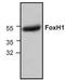 Forkhead Box H1 antibody, TA318996, Origene, Western Blot image 
