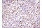 Bromodomain Containing 7 antibody, 15125S, Cell Signaling Technology, Immunohistochemistry paraffin image 
