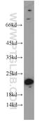 Complexin 3 antibody, 16949-1-AP, Proteintech Group, Western Blot image 