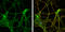 Reelin antibody, GTX133226, GeneTex, Immunocytochemistry image 