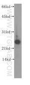 Calcium And Integrin Binding 1 antibody, 11823-1-AP, Proteintech Group, Western Blot image 