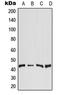 Diacylglycerol O-Acyltransferase 2 antibody, LS-C353597, Lifespan Biosciences, Western Blot image 