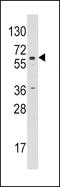 Cyp19 antibody, 63-003, ProSci, Western Blot image 