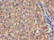 Vam6/Vps39-like protein antibody, LS-C680000, Lifespan Biosciences, Immunohistochemistry paraffin image 