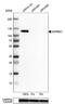 Sorbin And SH3 Domain Containing 1 antibody, NBP1-86641, Novus Biologicals, Western Blot image 