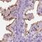 Membrane Metalloendopeptidase antibody, NBP2-49050, Novus Biologicals, Immunohistochemistry paraffin image 