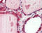 Cathepsin K antibody, 51-023, ProSci, Immunohistochemistry paraffin image 