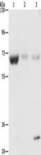 NEDD8 Activating Enzyme E1 Subunit 1 antibody, TA349492, Origene, Western Blot image 