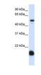 Solute carrier family 22 member 7 antibody, NBP1-62708, Novus Biologicals, Western Blot image 