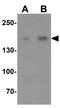 Kielin/chordin-like protein antibody, GTX32086, GeneTex, Western Blot image 