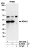 Acetyl-CoA Acyltransferase 1 antibody, A304-285A, Bethyl Labs, Immunoprecipitation image 
