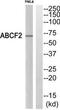 ATP Binding Cassette Subfamily F Member 2 antibody, TA312337, Origene, Western Blot image 